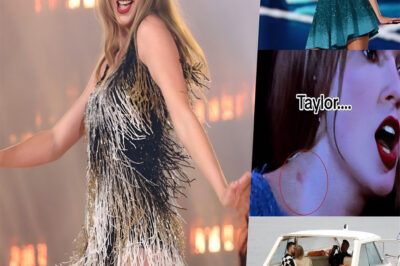 Video Taylor Swift fans notice a ‘hickey’ on her neck while performing in Sweden on Saturday.