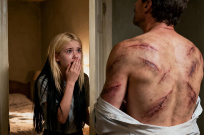 She Saw Her Dad’s Back for the First Time… and Her Whole World Changed…